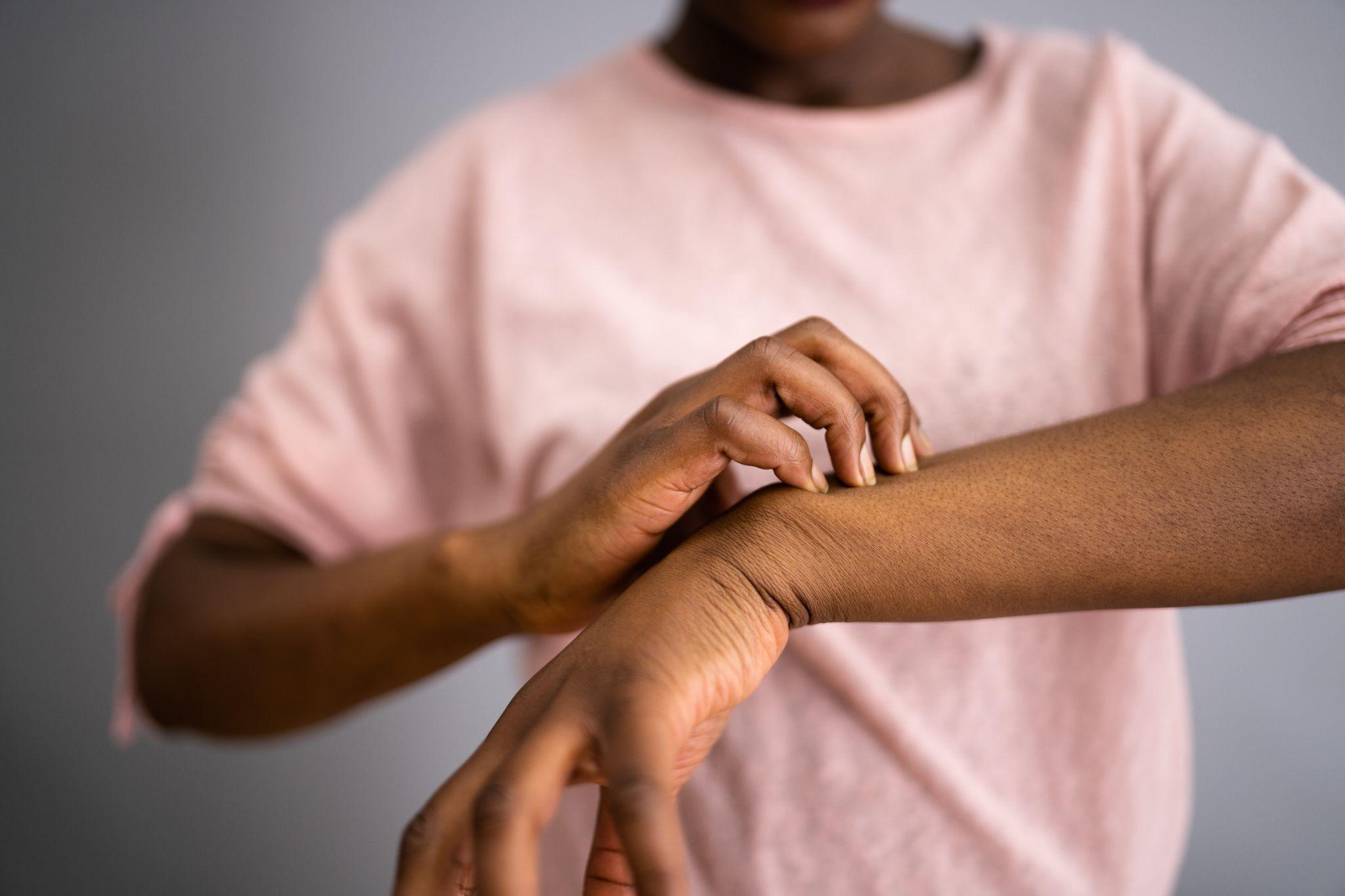 African American Woman With Itchy Skin